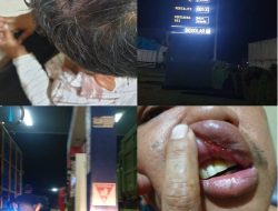Mirisss!!!!!!Viral Dimedsos Terjadi Pengeroyokan Wartawan di SPBU.14,292,645 Selensen Kec.Kemuning Kabupaten INHIL Provinsi Riau