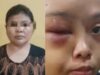 Mirisss!!!!! Derita VW (18) Anak Yatim yang Disiksa Tantenya Sendiri