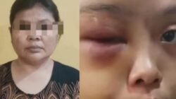 Mirisss!!!!! Derita VW (18) Anak Yatim yang Disiksa Tantenya Sendiri